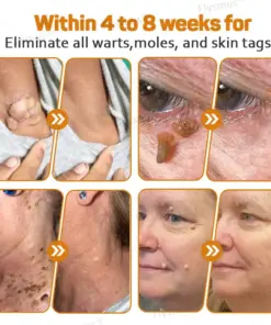Flysmus® Tag Recede Bee Venom Treatment Cream
