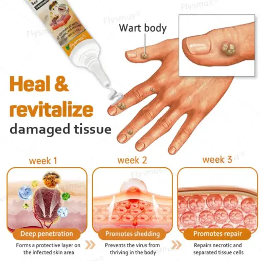 Flysmus® Tag Recede Bee Venom Treatment Cream