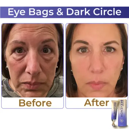 flysmus™ Collagen+ Bee Venom Roller Eye Cream