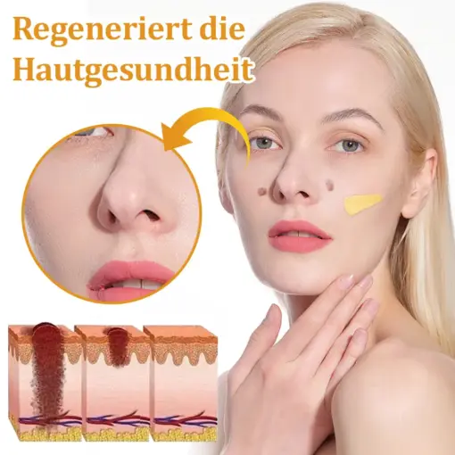 flysmus™ Starke Bienenvergiftungs-Reparaturcreme