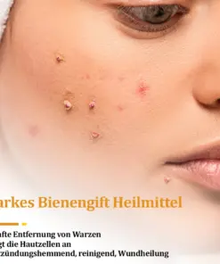 flysmus™ Starke Bienenvergiftungs-Reparaturcreme