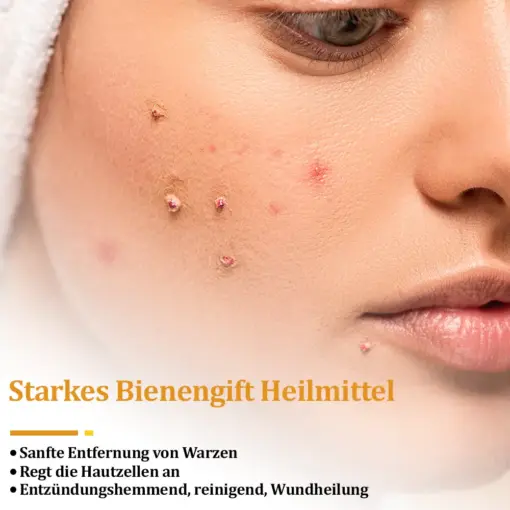 flysmus™ Starke Bienenvergiftungs-Reparaturcreme