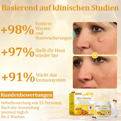 flysmus™ Starke Bienenvergiftungs-Reparaturcreme