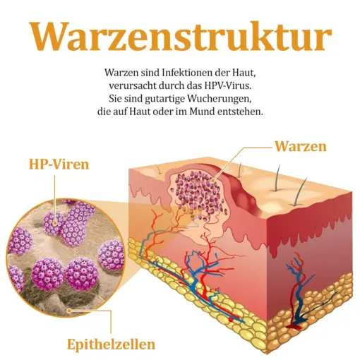 flysmus™ Starke Bienenvergiftungs-Reparaturcreme