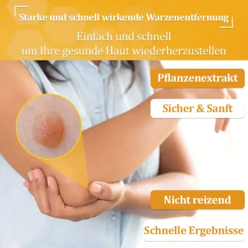 flysmus™ Starke Bienenvergiftungs-Reparaturcreme