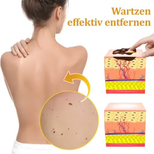 flysmus™ Starke Bienenvergiftungs-Reparaturcreme
