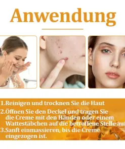 flysmus™ Starke Bienenvergiftungs-Reparaturcreme