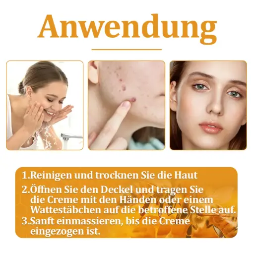 flysmus™ Starke Bienenvergiftungs-Reparaturcreme