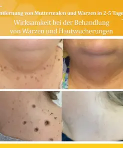 flysmus™ Starke Bienenvergiftungs-Reparaturcreme