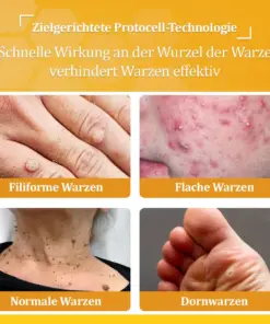 flysmus™ Starke Bienenvergiftungs-Reparaturcreme
