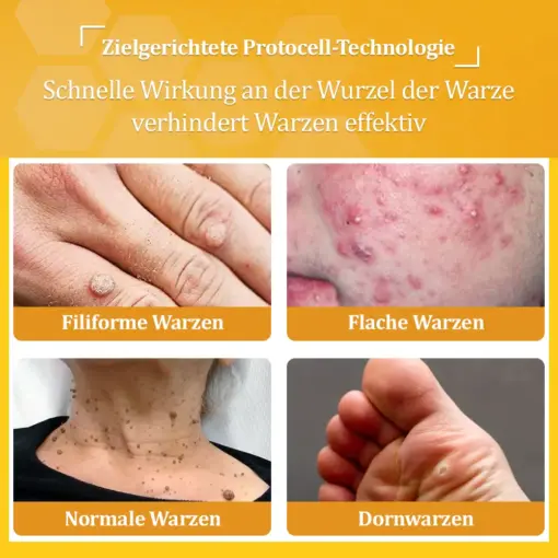flysmus™ Starke Bienenvergiftungs-Reparaturcreme