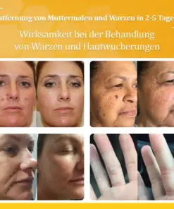 flysmus™ Starke Bienenvergiftungs-Reparaturcreme