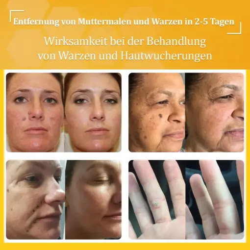 flysmus™ Starke Bienenvergiftungs-Reparaturcreme