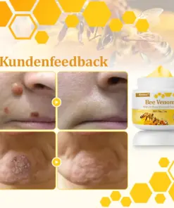 flysmus™ Starke Bienenvergiftungs-Reparaturcreme