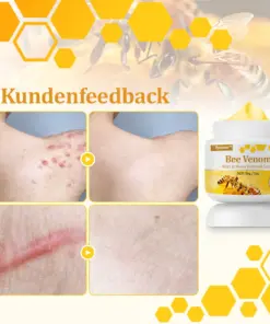 flysmus™ Starke Bienenvergiftungs-Reparaturcreme