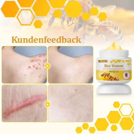 flysmus™ Starke Bienenvergiftungs-Reparaturcreme