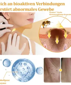 flysmus™ Starke Bienenvergiftungs-Reparaturcreme