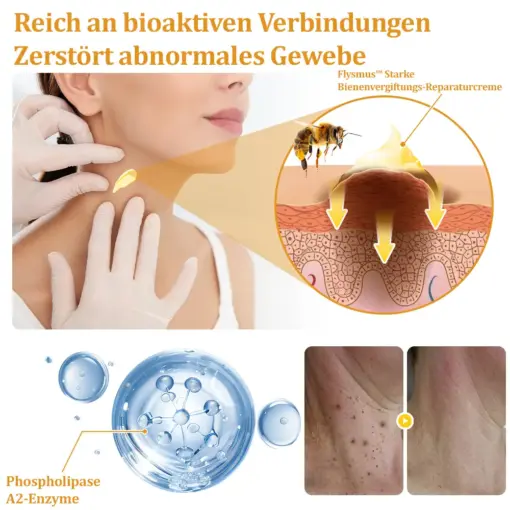 flysmus™ Starke Bienenvergiftungs-Reparaturcreme