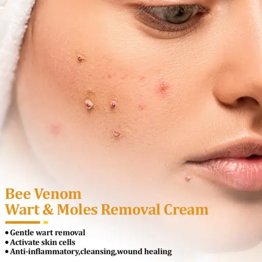 flysmus™ TagCure Bee Venom Cream