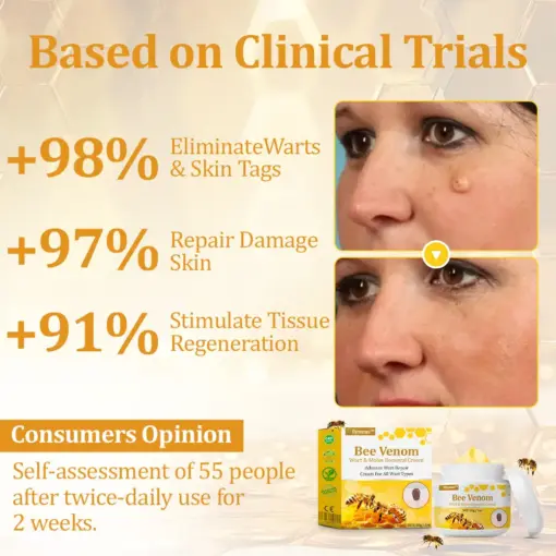 flysmus™ TagCure Bee Venom Cream