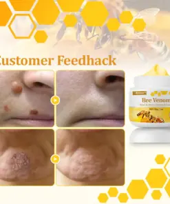 flysmus™ TagCure Bee Venom Cream