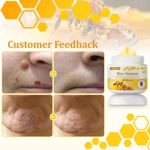 flysmus™ TagCure Bee Venom Cream
