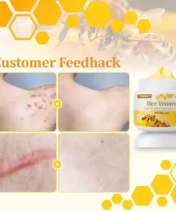 flysmus™ TagCure Bee Venom Cream