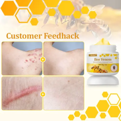 flysmus™ TagCure Bee Venom Cream