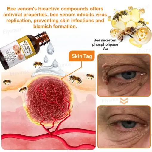 Flysmus® Bee Venom Skin Repair Treatment Serum
