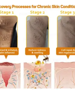 Flysmus® Bee Venom Skin Repair Treatment Serum
