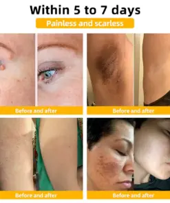 Flysmus® Bee Venom Skin Repair Treatment Serum
