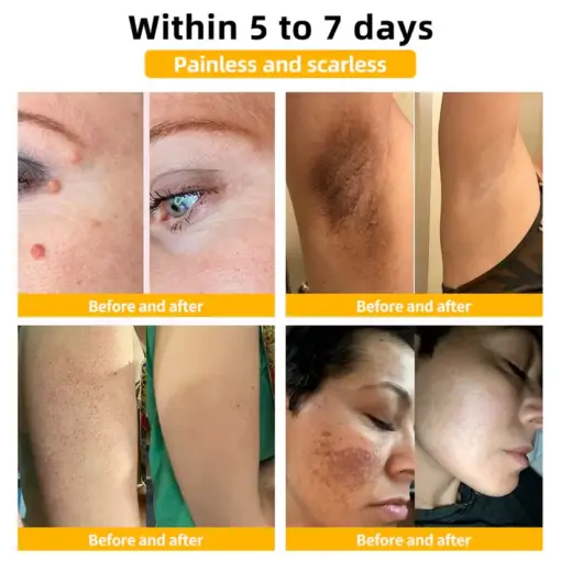 Flysmus® Bee Venom Skin Repair Treatment Serum