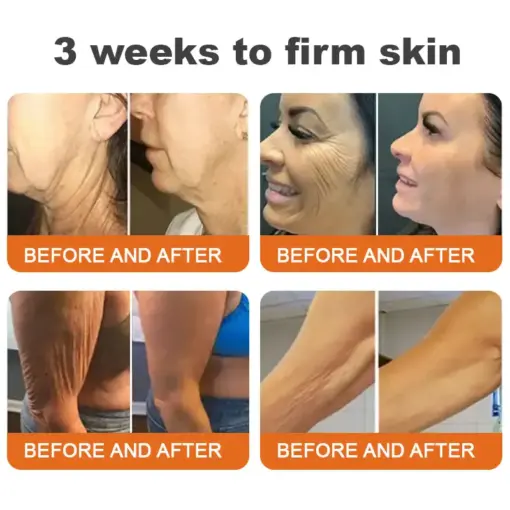 Flysmus® Botox Bee Venom Firming Serum Stick
