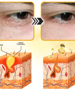 Flysmus® Face Oil Seeds Bee Venom Treatment Cream