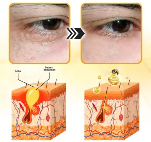 Flysmus® Face Oil Seeds Bee Venom Treatment Cream