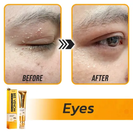Flysmus® Face Oil Seeds Bee Venom Treatment Cream