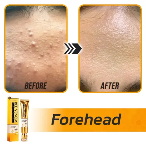 Flysmus® Face Oil Seeds Bee Venom Treatment Cream