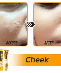 Flysmus® Face Oil Seeds Bee Venom Treatment Cream