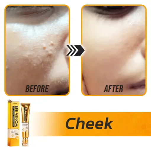 Flysmus® Face Oil Seeds Bee Venom Treatment Cream