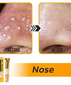 Flysmus® Face Oil Seeds Bee Venom Treatment Cream