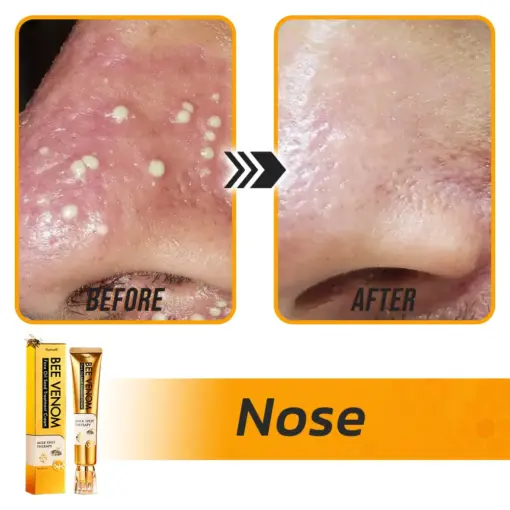 Flysmus® Face Oil Seeds Bee Venom Treatment Cream
