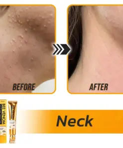 Flysmus® Face Oil Seeds Bee Venom Treatment Cream