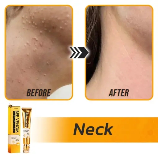 Flysmus® Face Oil Seeds Bee Venom Treatment Cream