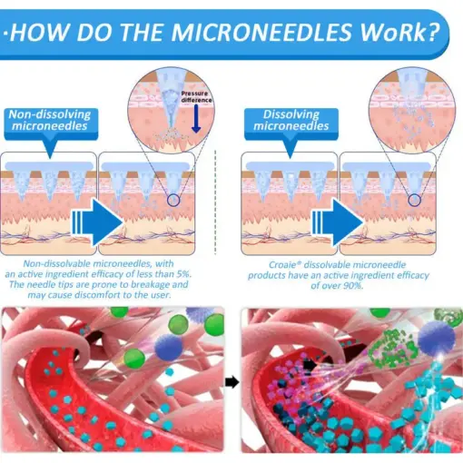Flysmus® Nano Microneedle Patch with SMGT-GLP-1 & Matrixyl 3000