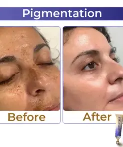 flysmus® Collagen+ Bee Venom Roller Eye Cream