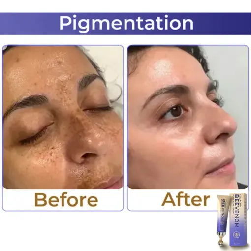 flysmus® Collagen+ Bee Venom Roller Eye Cream