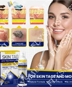 FLYSMUS® SKIN TAG CRYO TREATMENT SPRAY ACE