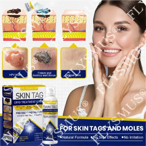 FLYSMUS® SKIN TAG CRYO TREATMENT SPRAY ACE