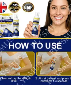 FLYSMUS® SKIN TAG CRYO TREATMENT SPRAY ACE