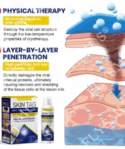 FLYSMUS® SKIN TAG CRYO TREATMENT SPRAY ACE